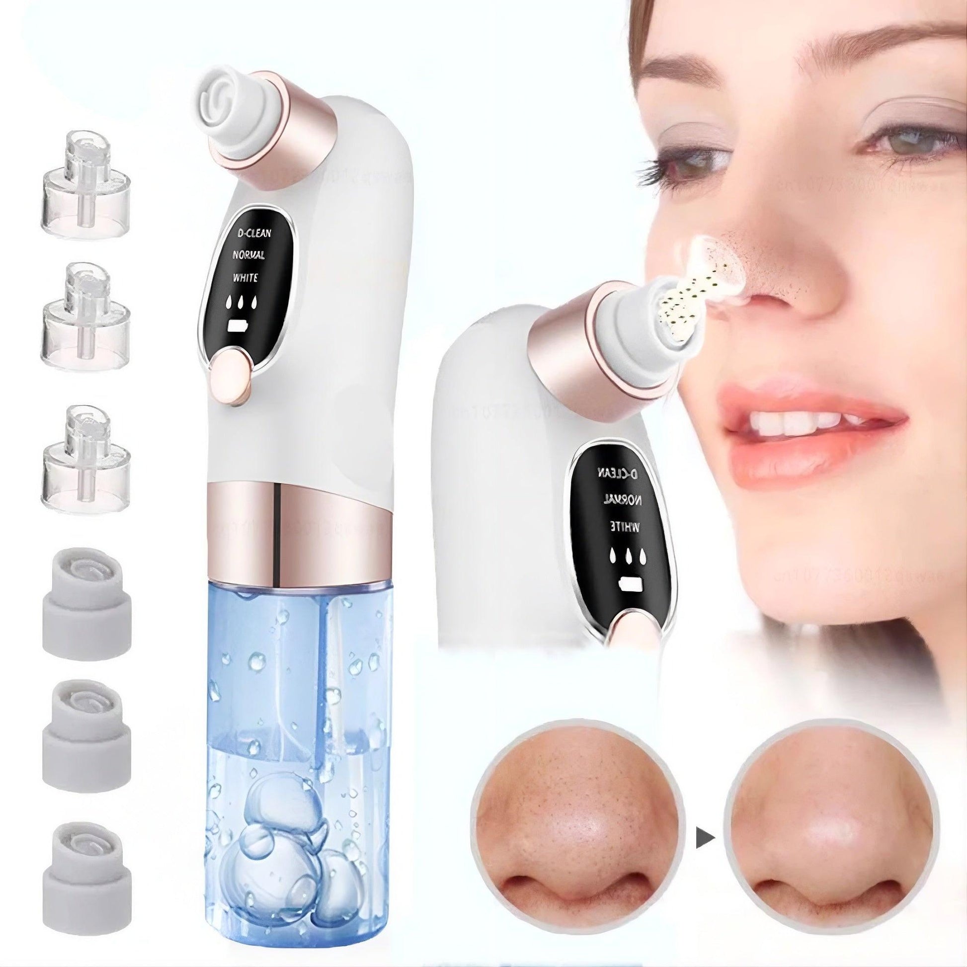 Pore Vacuum Blackhead Remover – main product image | Buzzora