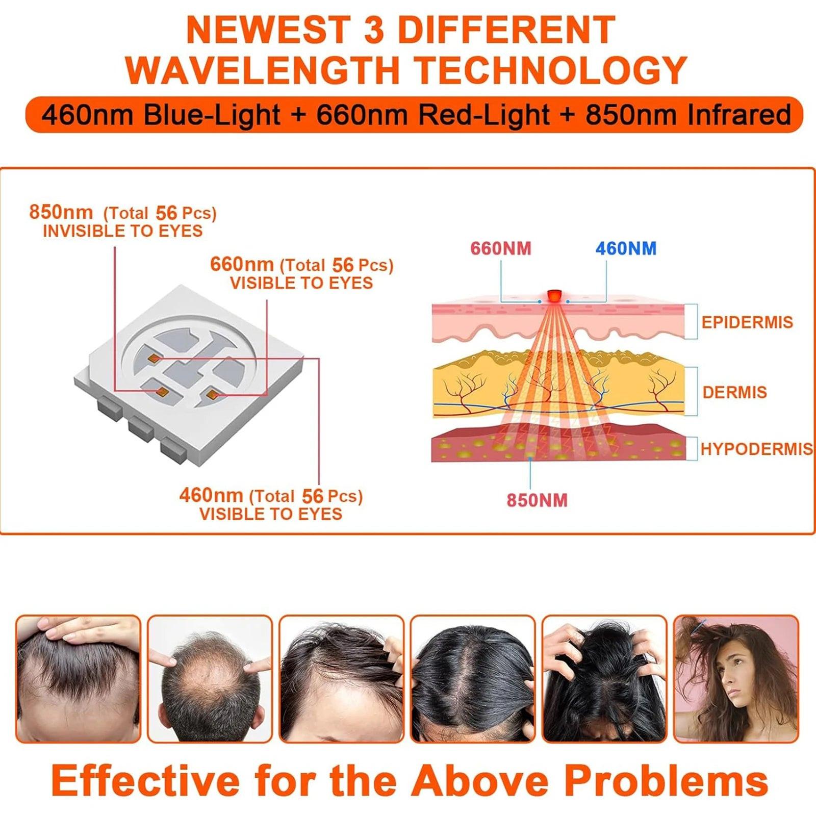 Red Light Hair Growth Cap – product detail view | Buzzora