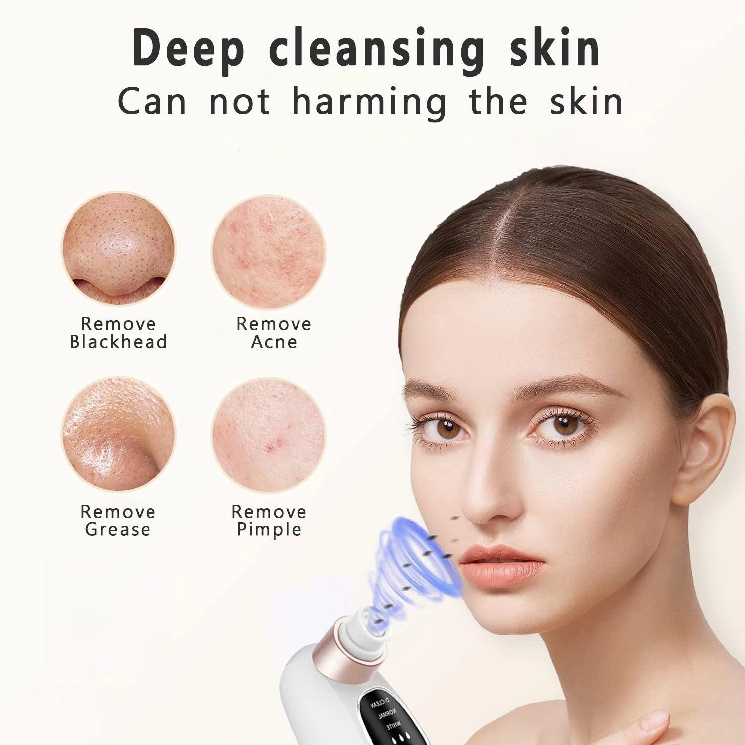Pore Vacuum Blackhead Remover – product detail view | Buzzora