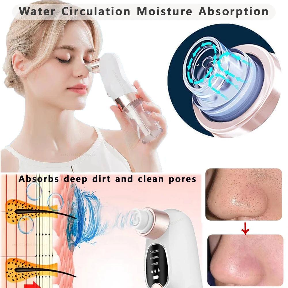 Pore Vacuum Blackhead Remover – features and benefits | Buzzora