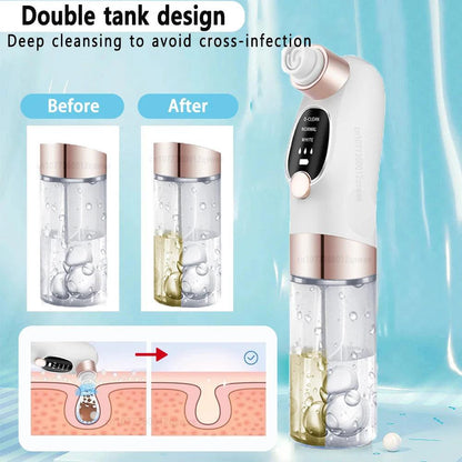 Pore Vacuum Blackhead Remover – size and color options | Buzzora