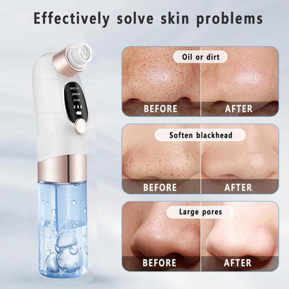 Pore Vacuum Blackhead Remover – lifestyle use photo | Buzzora