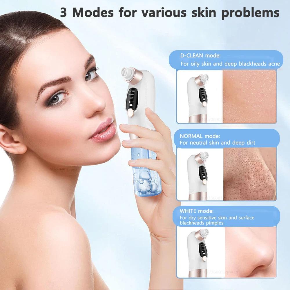 Pore Vacuum Blackhead Remover – additional angle | Buzzora